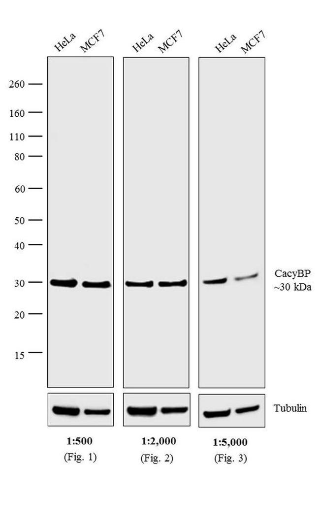 Rabbit IgG (H+L) Cross-Adsorbed Secondary Antibody in Western Blot (WB)
