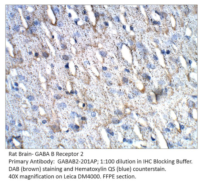 GABA B Receptor 2 Antibody in Immunohistochemistry (IHC)