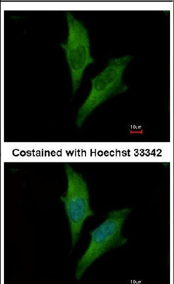 GABARAP Antibody in Immunocytochemistry (ICC/IF)