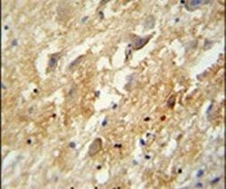 GABBR2 Antibody in Immunohistochemistry (IHC)