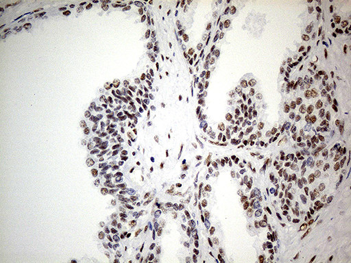 GABPB1 Antibody in Immunohistochemistry (Paraffin) (IHC (P))