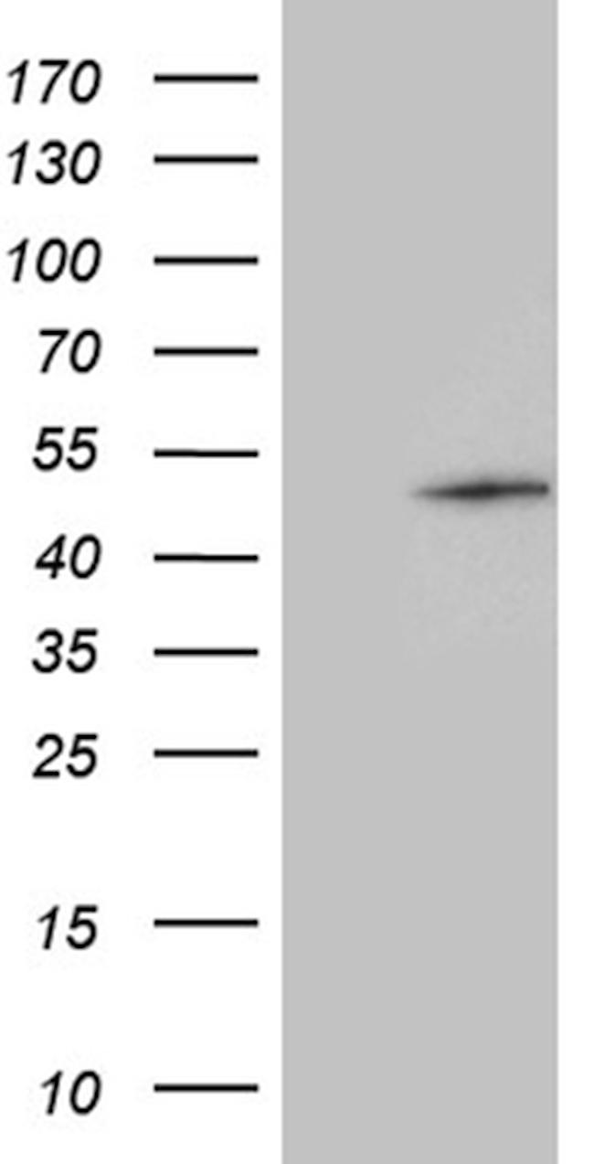 GABPB1 Antibody in Western Blot (WB)