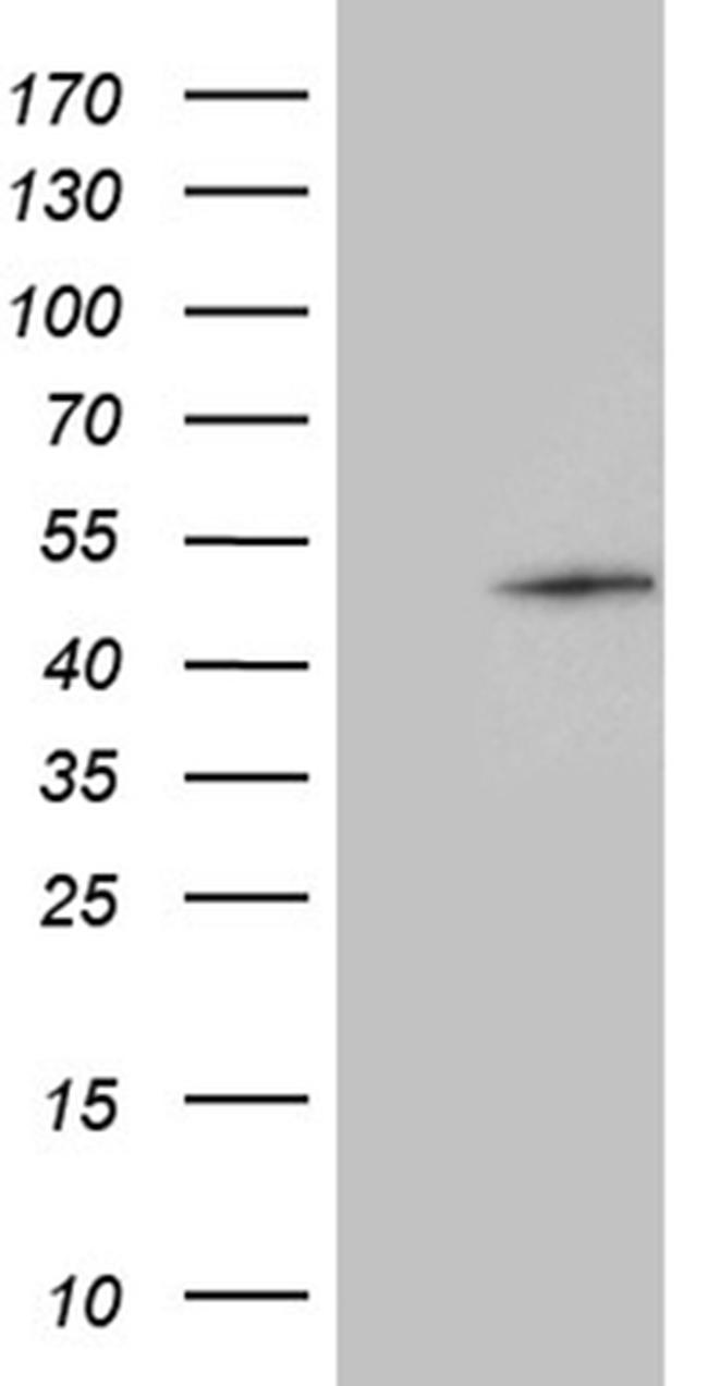 GABPB1 Antibody in Western Blot (WB)