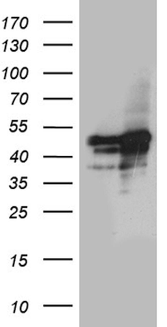 GABPB1 Antibody in Western Blot (WB)
