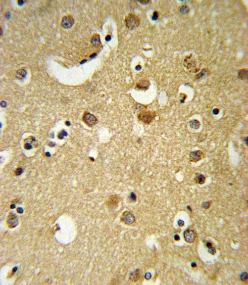 GABRA2 Antibody in Immunohistochemistry (IHC)