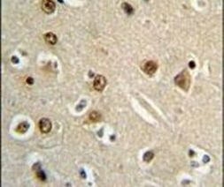 GABRA4 Antibody in Immunohistochemistry (IHC)