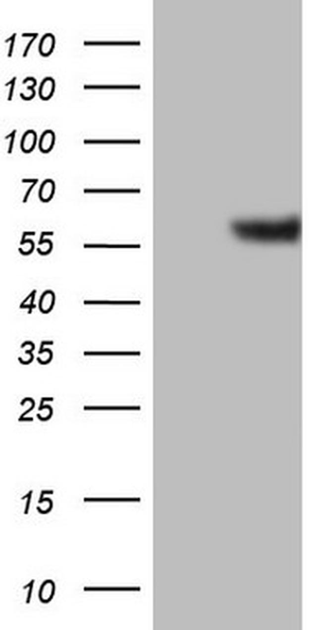 GABRA5 Antibody in Western Blot (WB)
