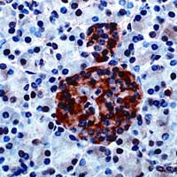 GAD65 Antibody in Immunohistochemistry (IHC)
