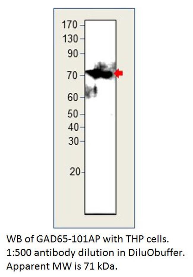 GAD65 Antibody in Western Blot (WB)