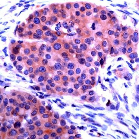 CHOP Antibody in Immunohistochemistry (IHC)