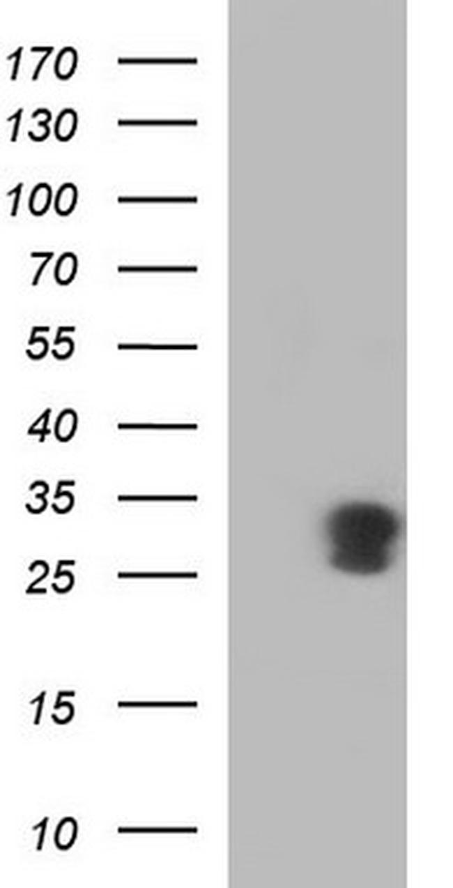 GADD45A Antibody in Western Blot (WB)