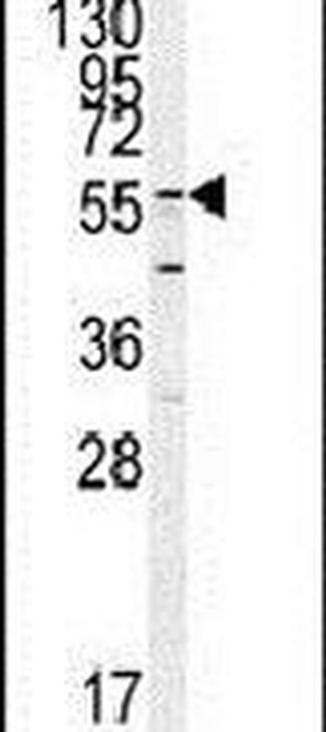 GADL1 Antibody in Western Blot (WB)