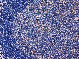 GALE Antibody in Immunohistochemistry (Paraffin) (IHC (P))