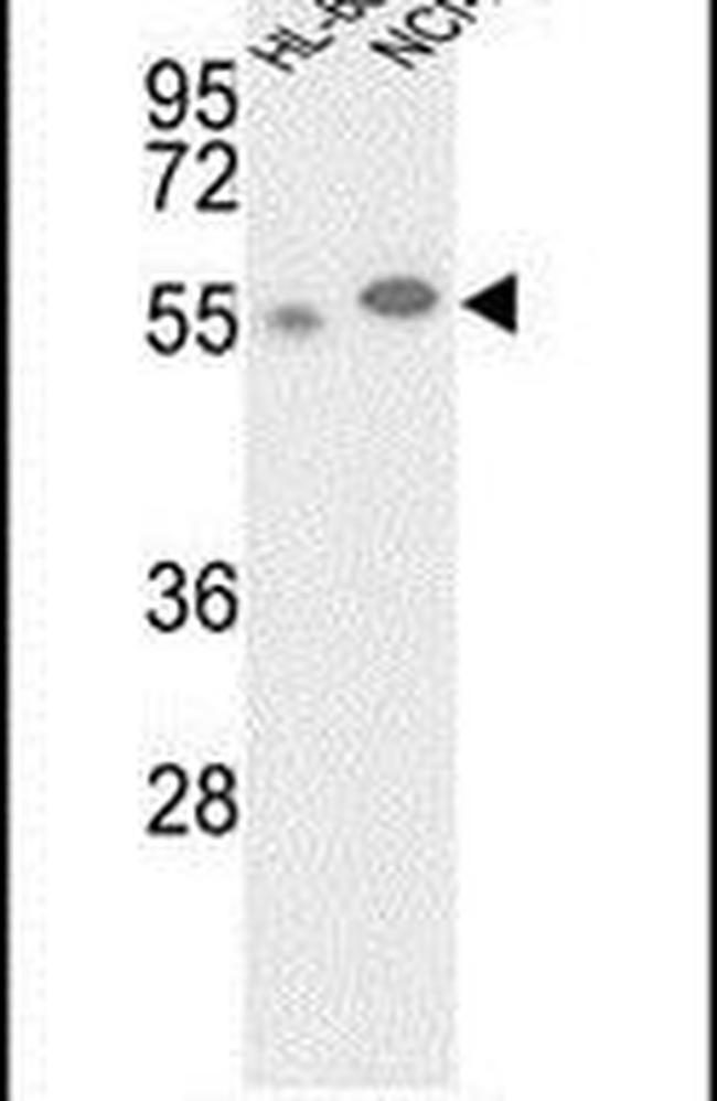 GALK2 Antibody in Western Blot (WB)