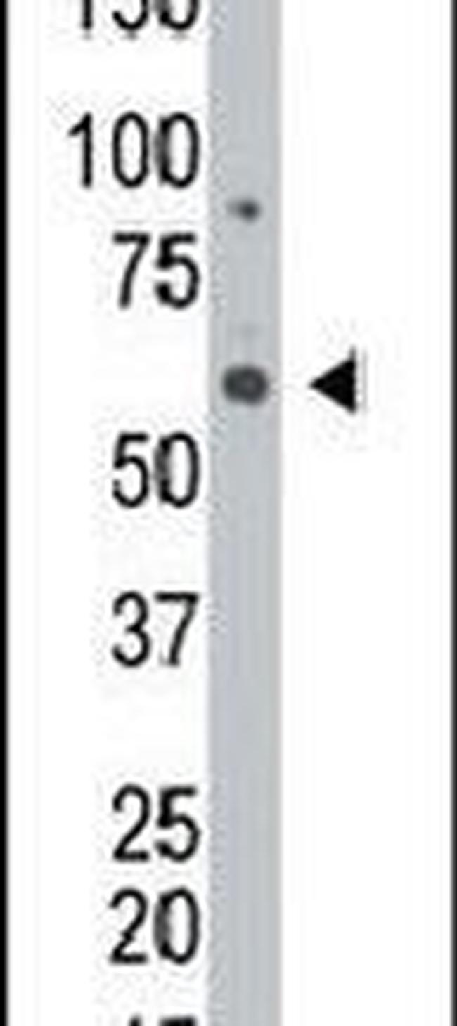 GALK2 Antibody in Western Blot (WB)