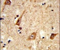 GALNT2 Antibody in Immunohistochemistry (IHC)
