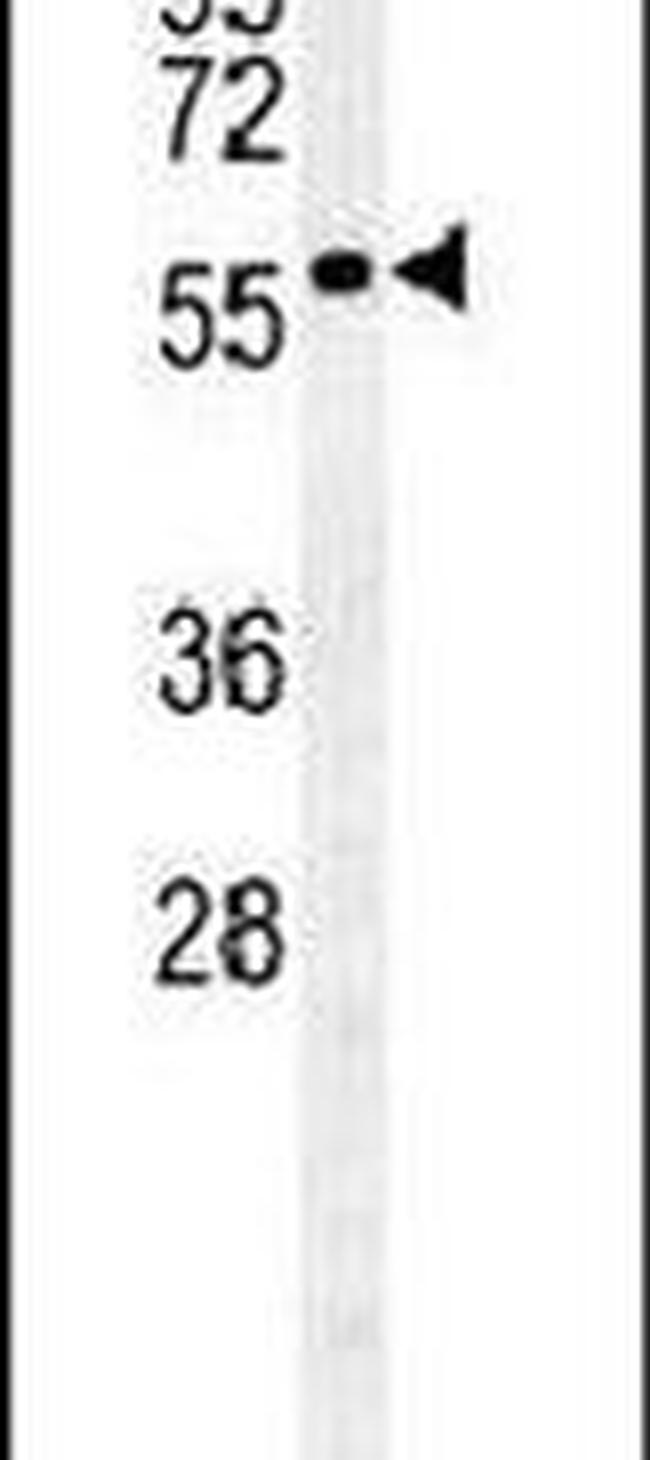 GALNT4 Antibody in Western Blot (WB)