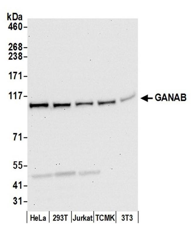 GANAB/Glucosidase II Subunit alpha Antibody in Western Blot (WB)