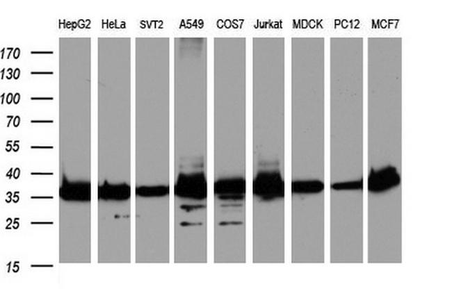 GAPDH Antibody in Western Blot (WB)