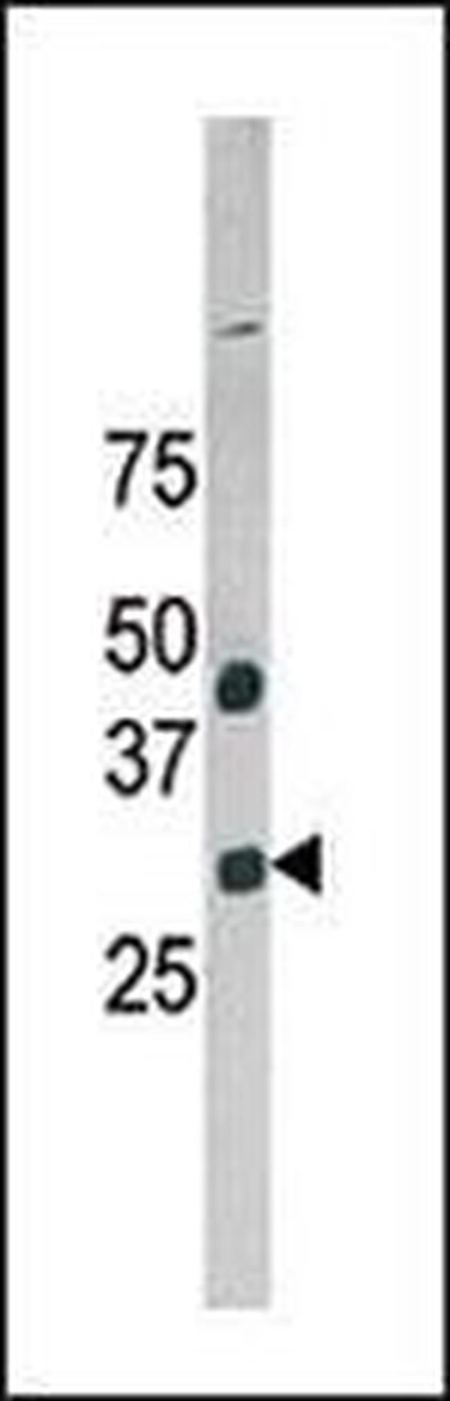 GAS41 Antibody in Western Blot (WB)