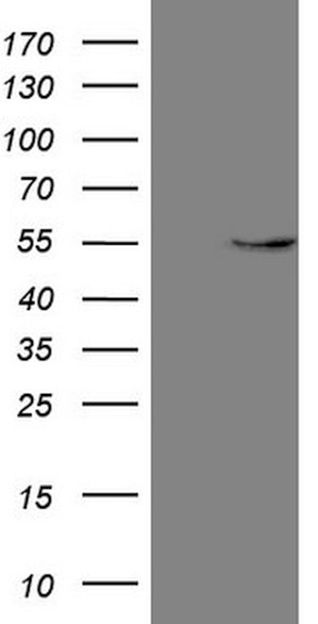 GAS8 Antibody in Western Blot (WB)
