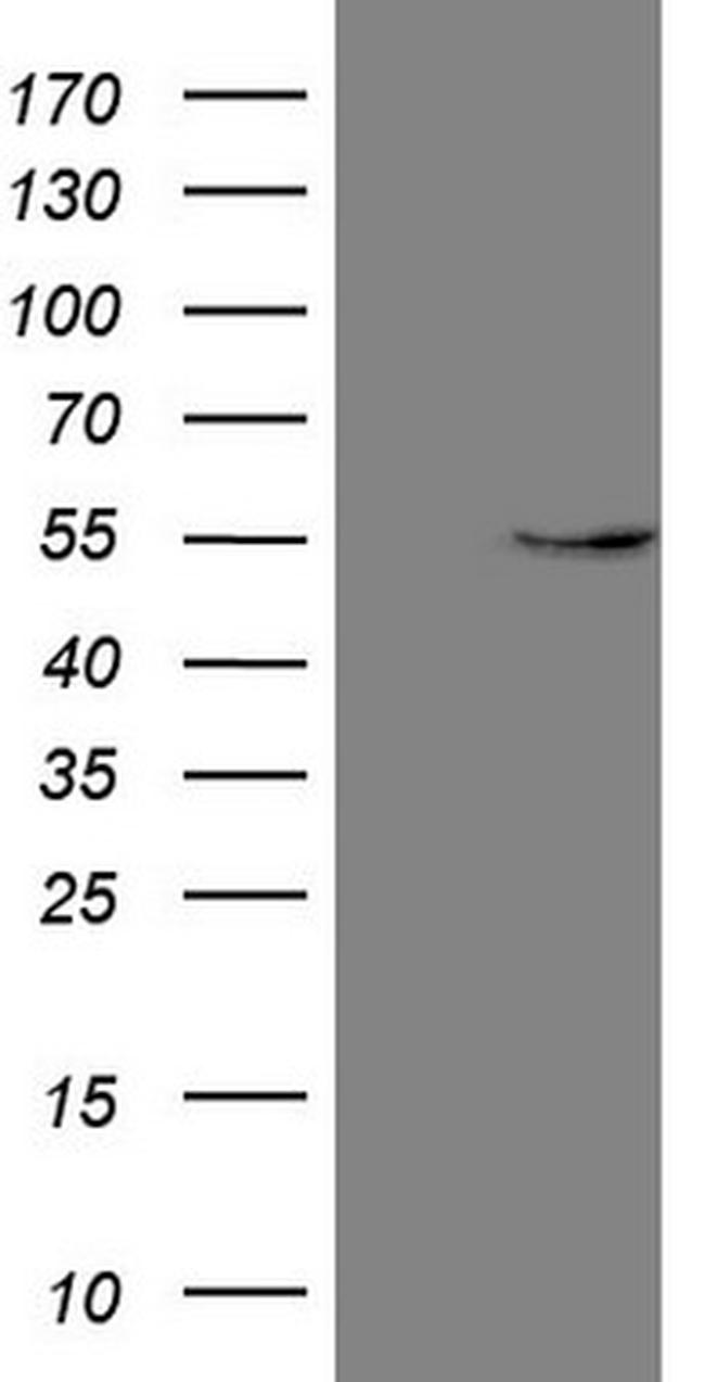 GAS8 Antibody in Western Blot (WB)