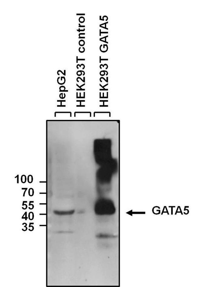 GATA5 Antibody in Western Blot (WB)