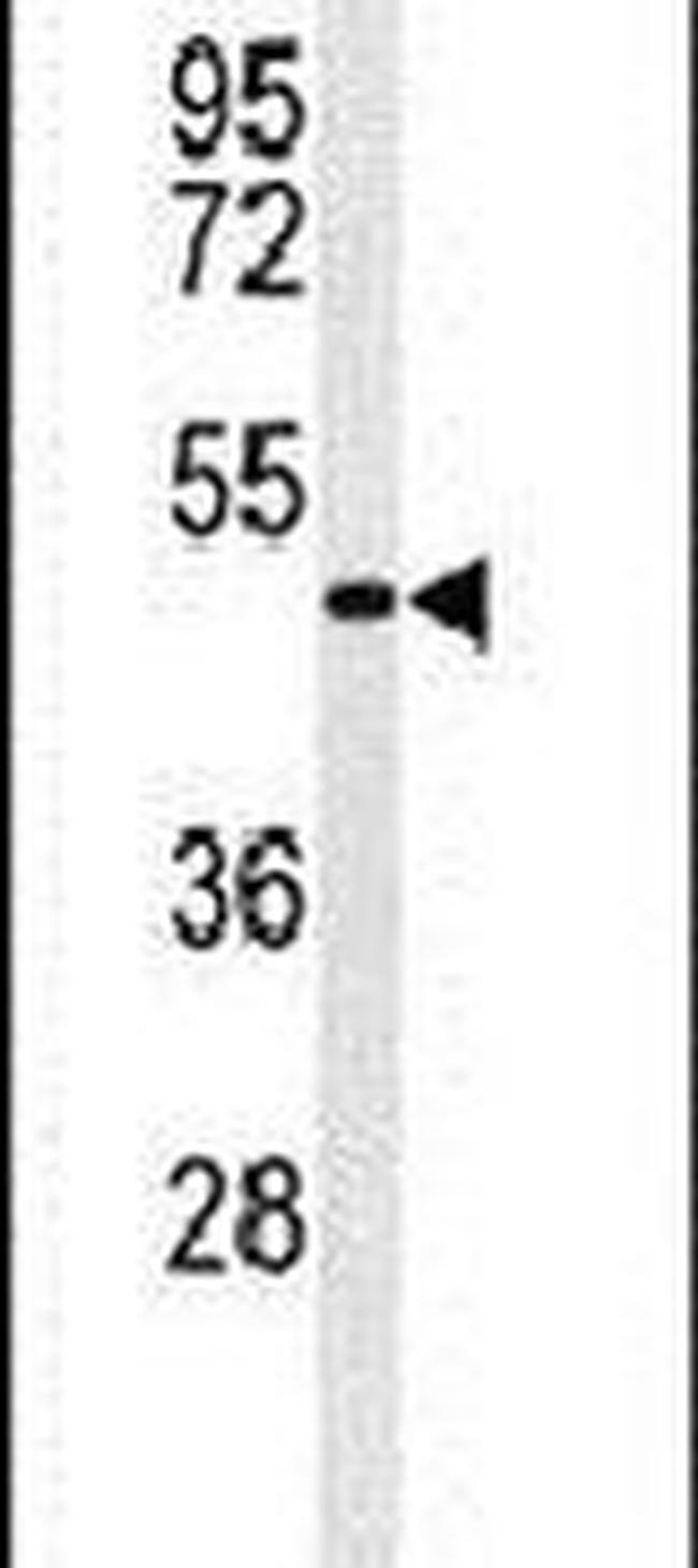 GATA6 Antibody in Western Blot (WB)