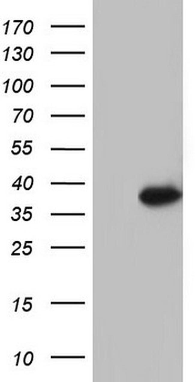 GATAD1 Antibody in Western Blot (WB)