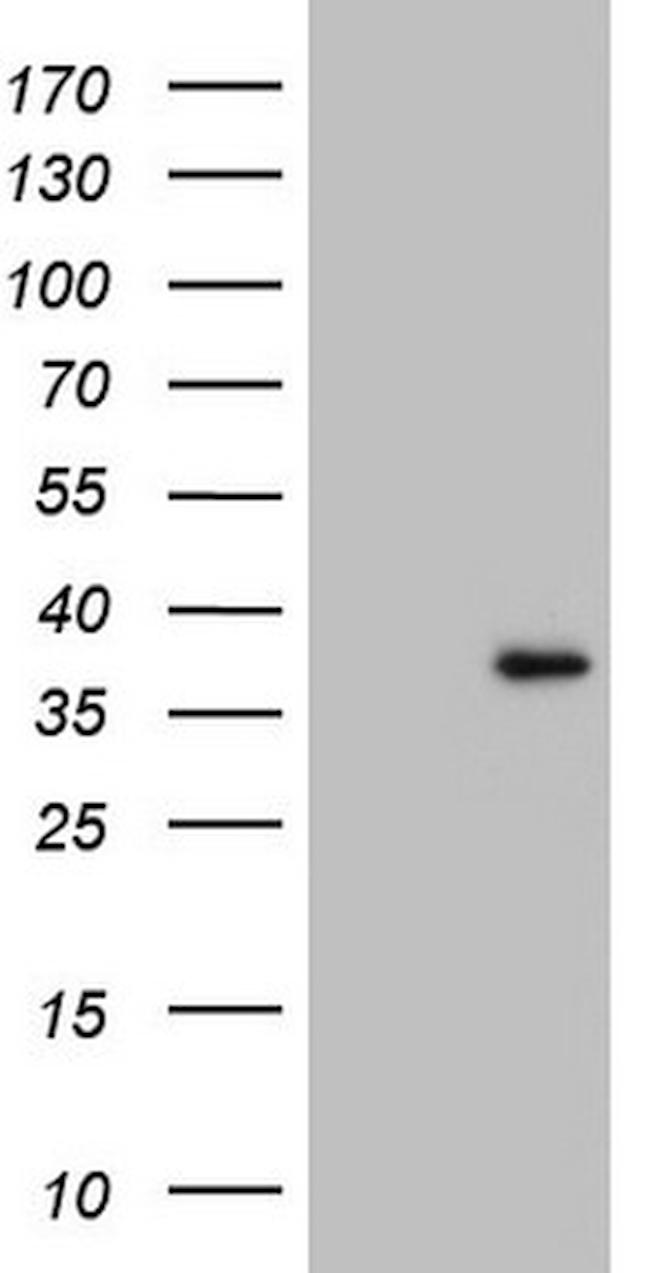 GATAD1 Antibody in Western Blot (WB)