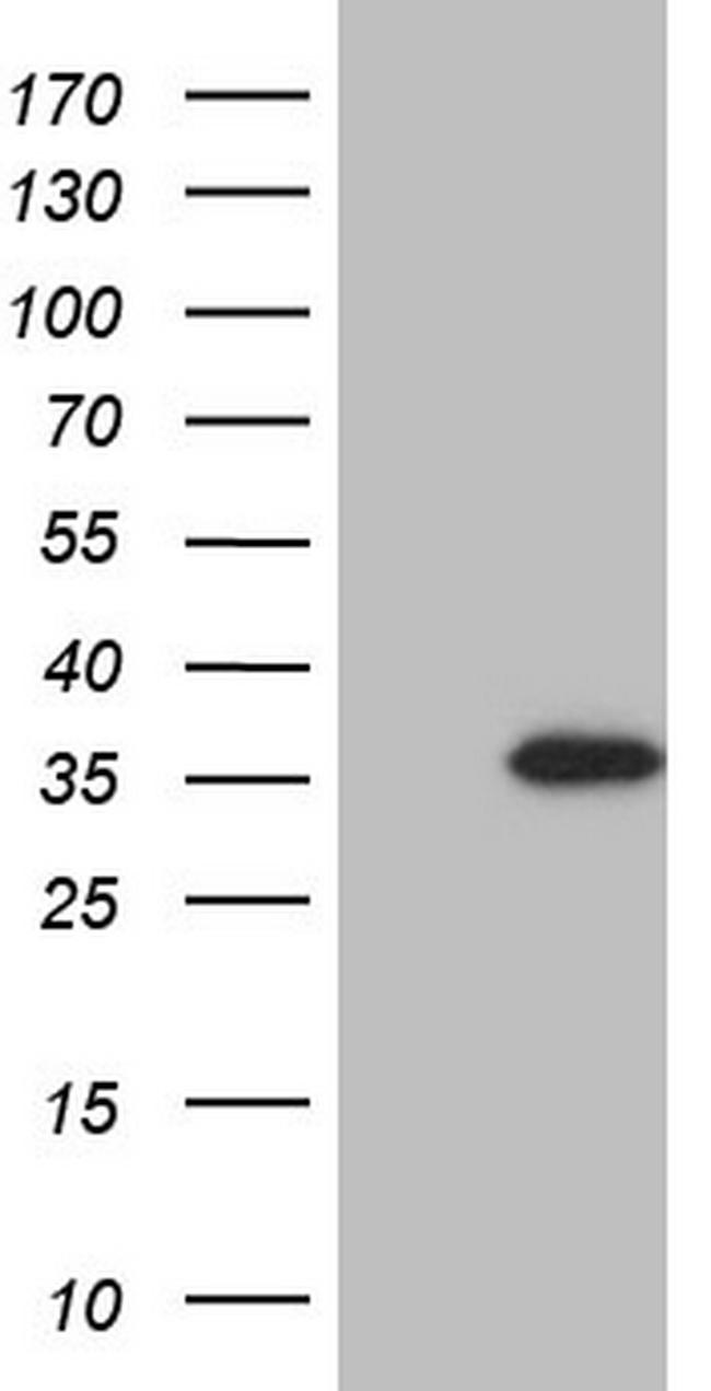 GATAD1 Antibody in Western Blot (WB)