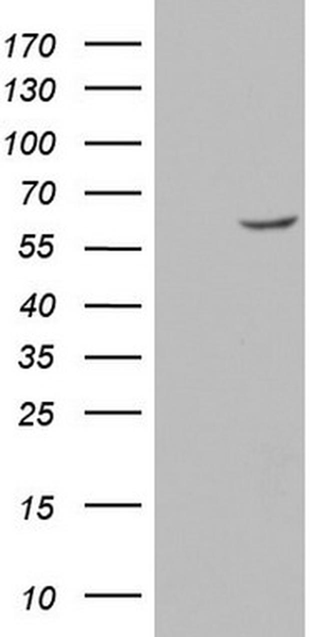 GBA Antibody in Western Blot (WB)
