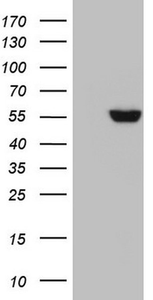 GBA Antibody in Western Blot (WB)