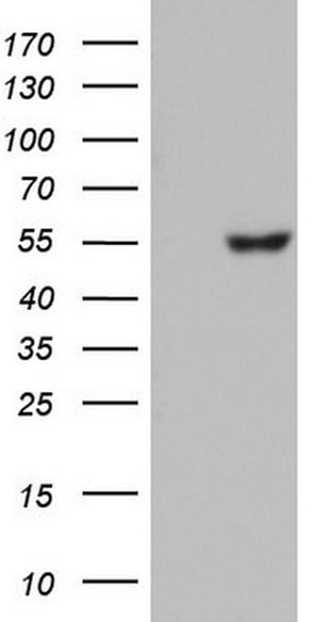 GBA Antibody in Western Blot (WB)