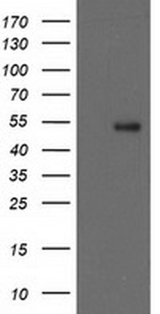 GBA3 Antibody in Western Blot (WB)