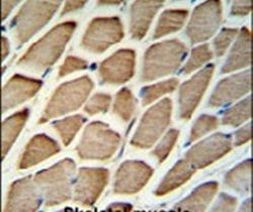 GBAS Antibody in Immunohistochemistry (IHC)