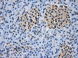 GBE1 Antibody in Immunohistochemistry (Paraffin) (IHC (P))
