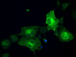 GBP2 Antibody in Immunocytochemistry (ICC/IF)