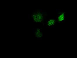 GBP5 Antibody in Immunocytochemistry (ICC/IF)