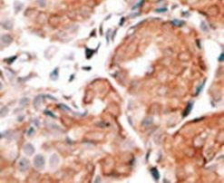 GCAP1 Antibody in Immunohistochemistry (IHC)