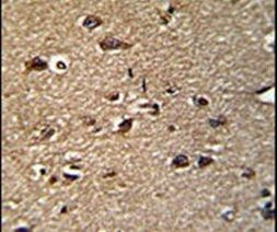 GCAT Antibody in Immunohistochemistry (IHC)