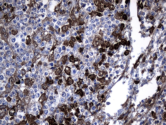 GCH1 Antibody in Immunohistochemistry (Paraffin) (IHC (P))