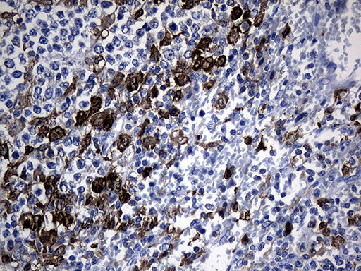 GCH1 Antibody in Immunohistochemistry (Paraffin) (IHC (P))