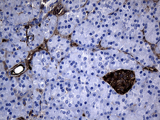 GCH1 Antibody in Immunohistochemistry (Paraffin) (IHC (P))