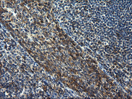 GCLC Antibody in Immunohistochemistry (Paraffin) (IHC (P))