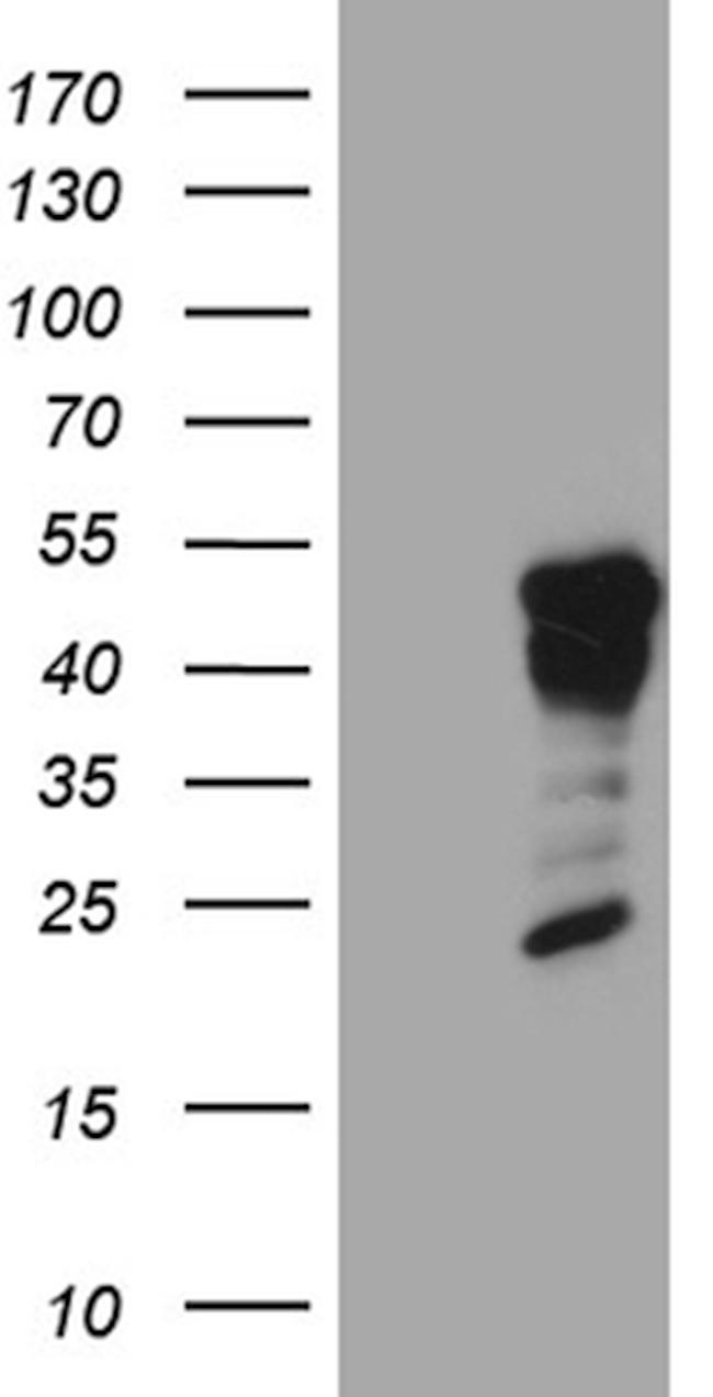 GCM1 Antibody in Western Blot (WB)