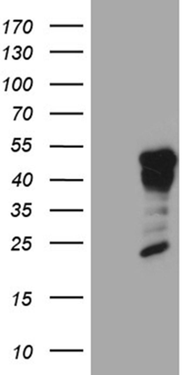 GCM1 Antibody in Western Blot (WB)