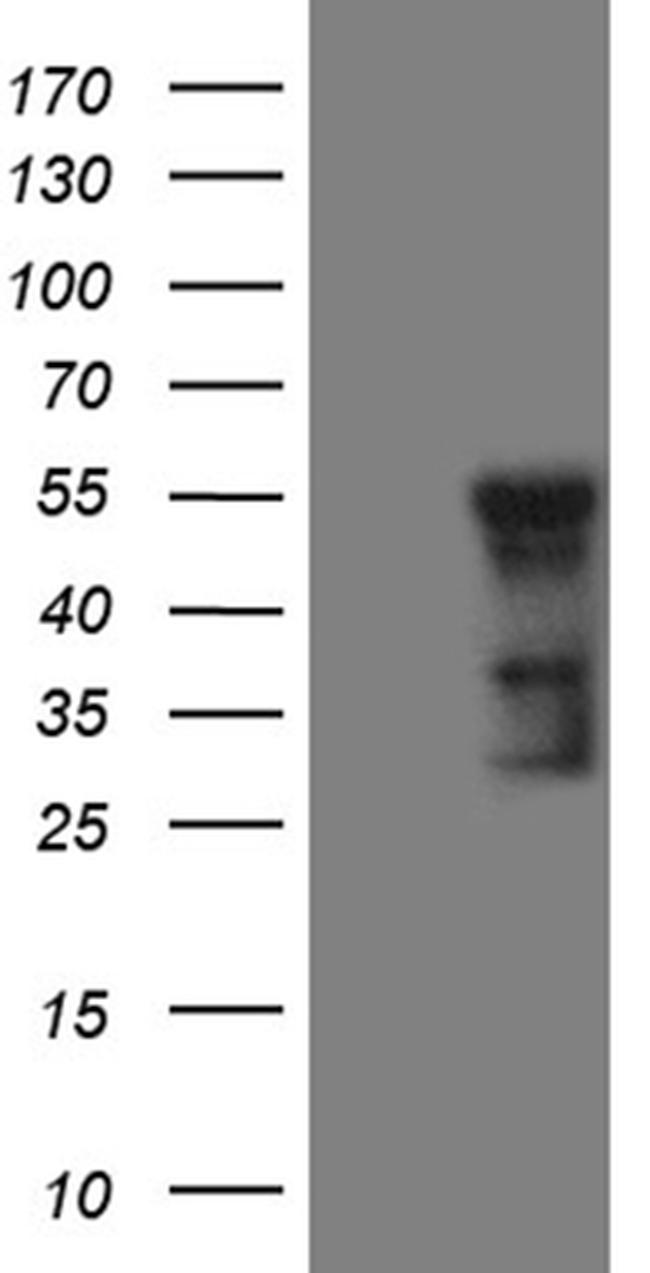 GCM1 Antibody in Western Blot (WB)