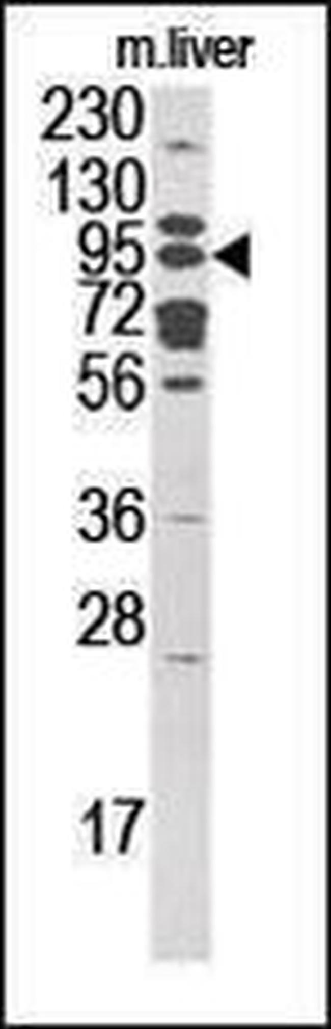 GCS1 Antibody in Western Blot (WB)