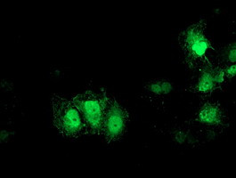 GDAP1L1 Antibody in Immunocytochemistry (ICC/IF)